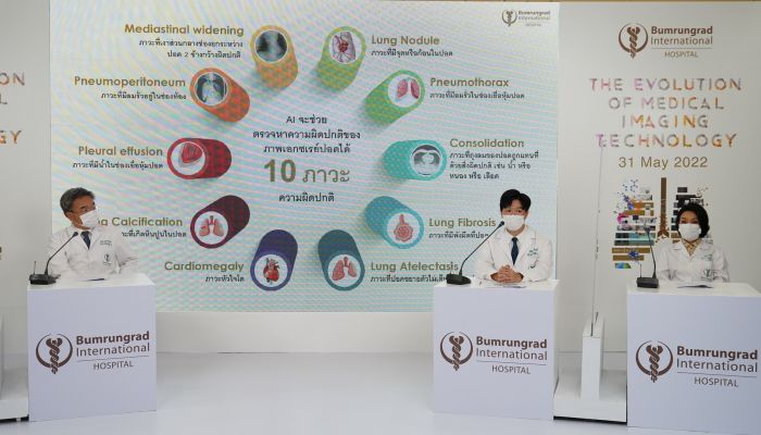บำรุงราษฎร์ เปิดตัว Radiology AI ปัญญาประดิษฐ์ทางรังสีวิทยา ผู้ช่วยรังสีแพทย์ในการวิเคราะห์ และระบุตำแหน่งภาวะความผิดปกติของปอด – มะเร็งเต้านม