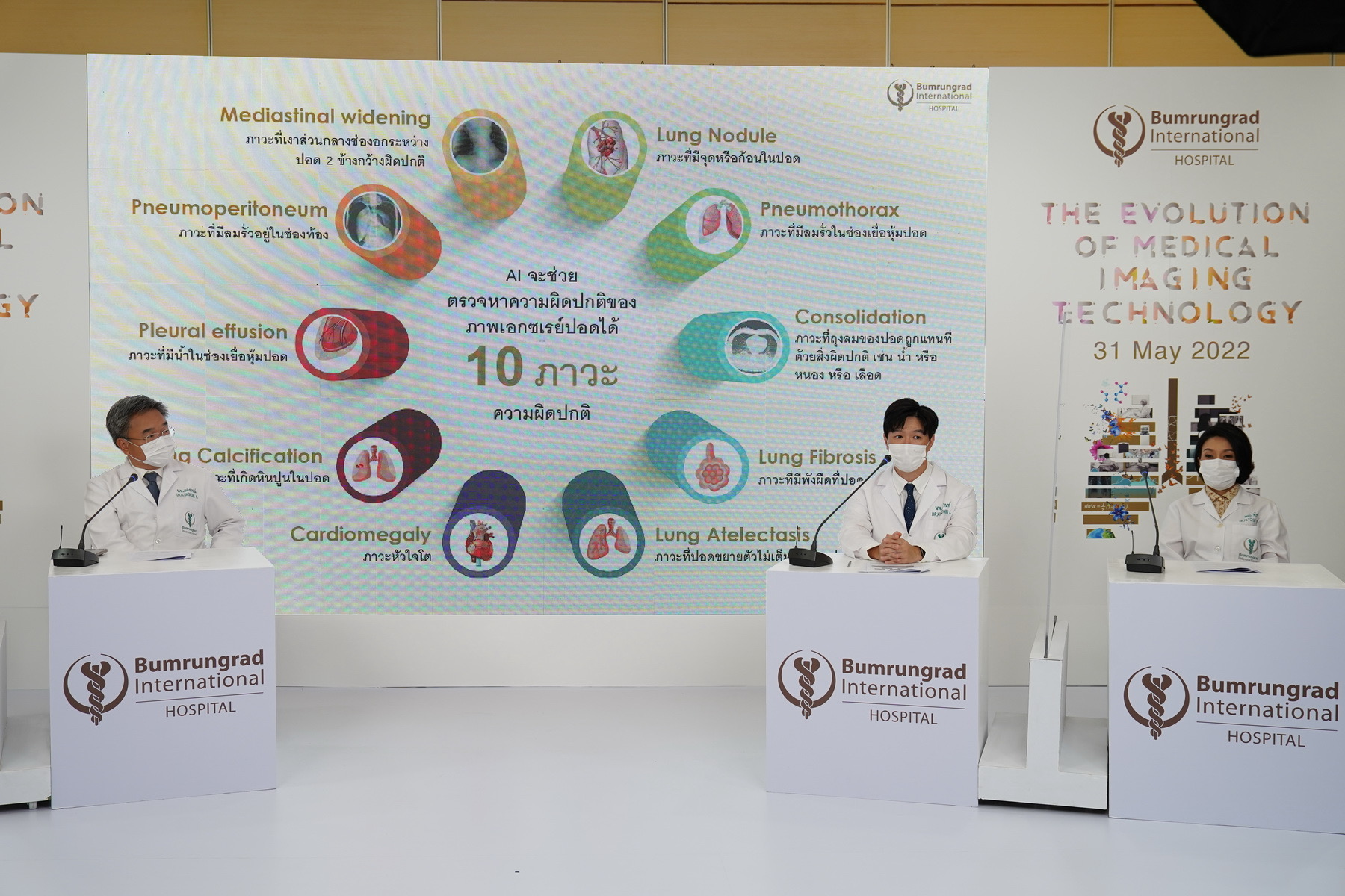 บำรุงราษฎร์ เปิดตัว Radiology AI ปัญญาประดิษฐ์ทางรังสีวิทยา ผู้ช่วยรังสีแพทย์ในการวิเคราะห์ และระบุตำแหน่งภาวะความผิดปกติของปอด – มะเร็งเต้านม